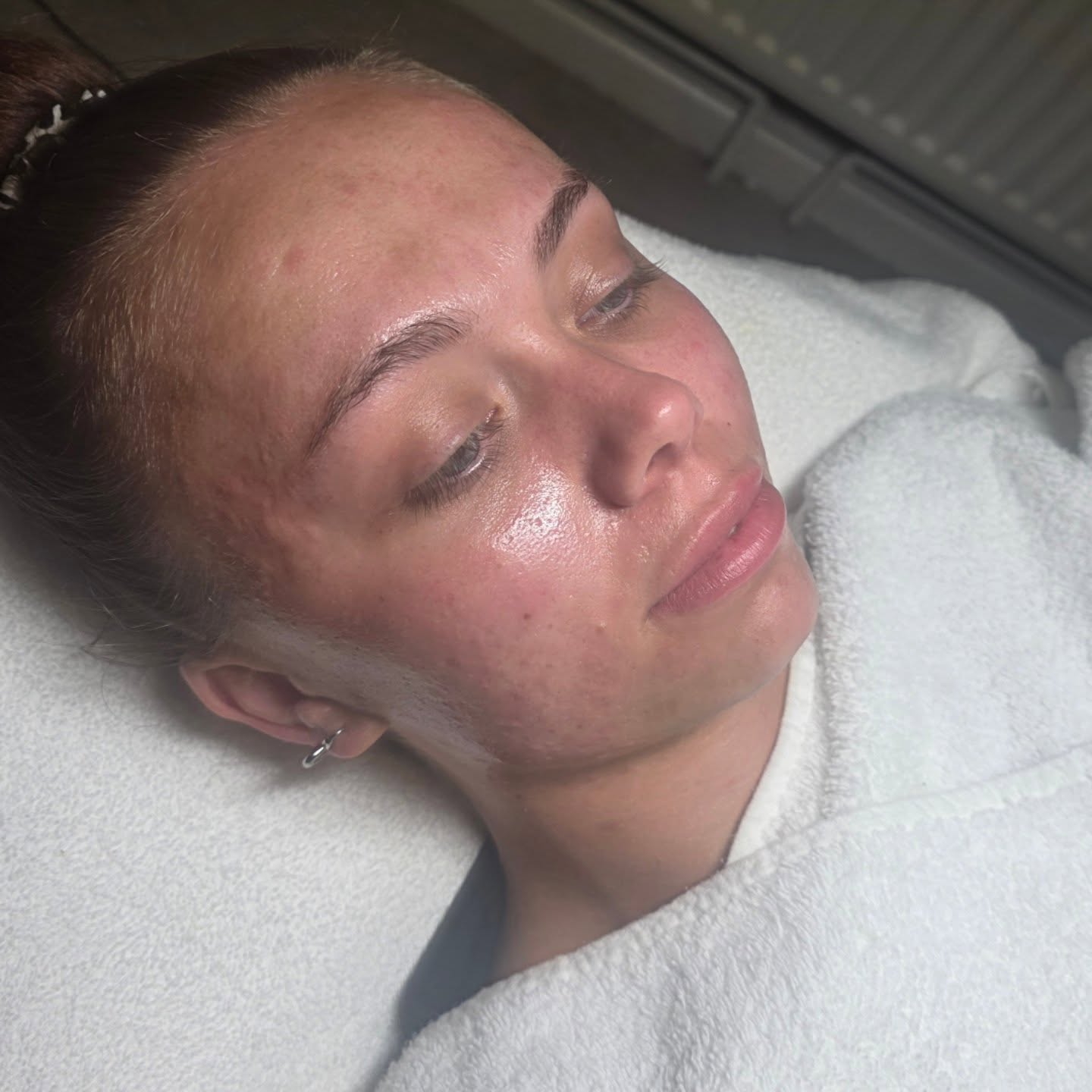 Beauty treatment result
